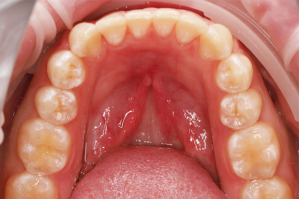 After image