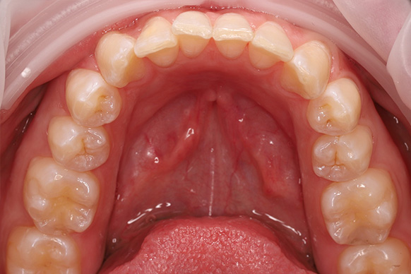 Before image